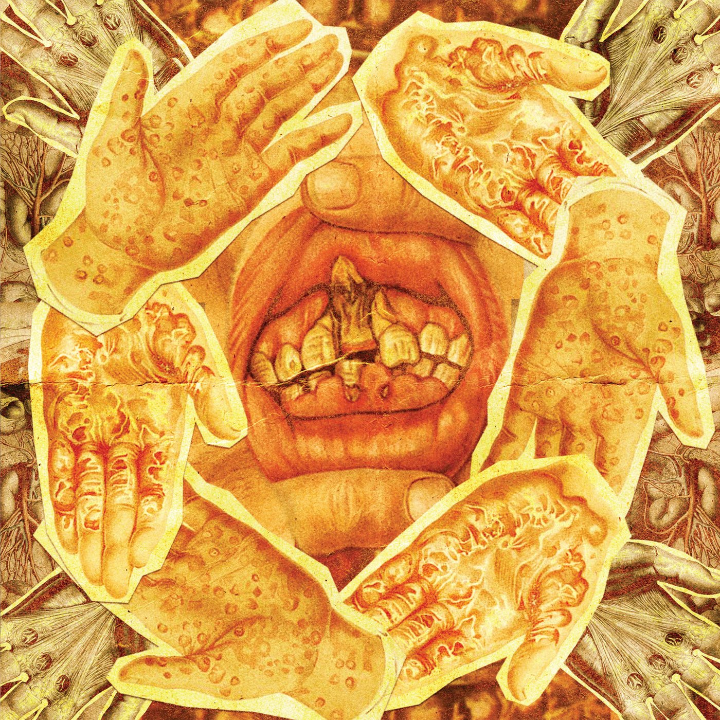 Lymphatic Phlegm – Vulgar Tissue Excavators and Morbid Organ Plastinators (Practitioners of Purulent Excisions) 7&quot;