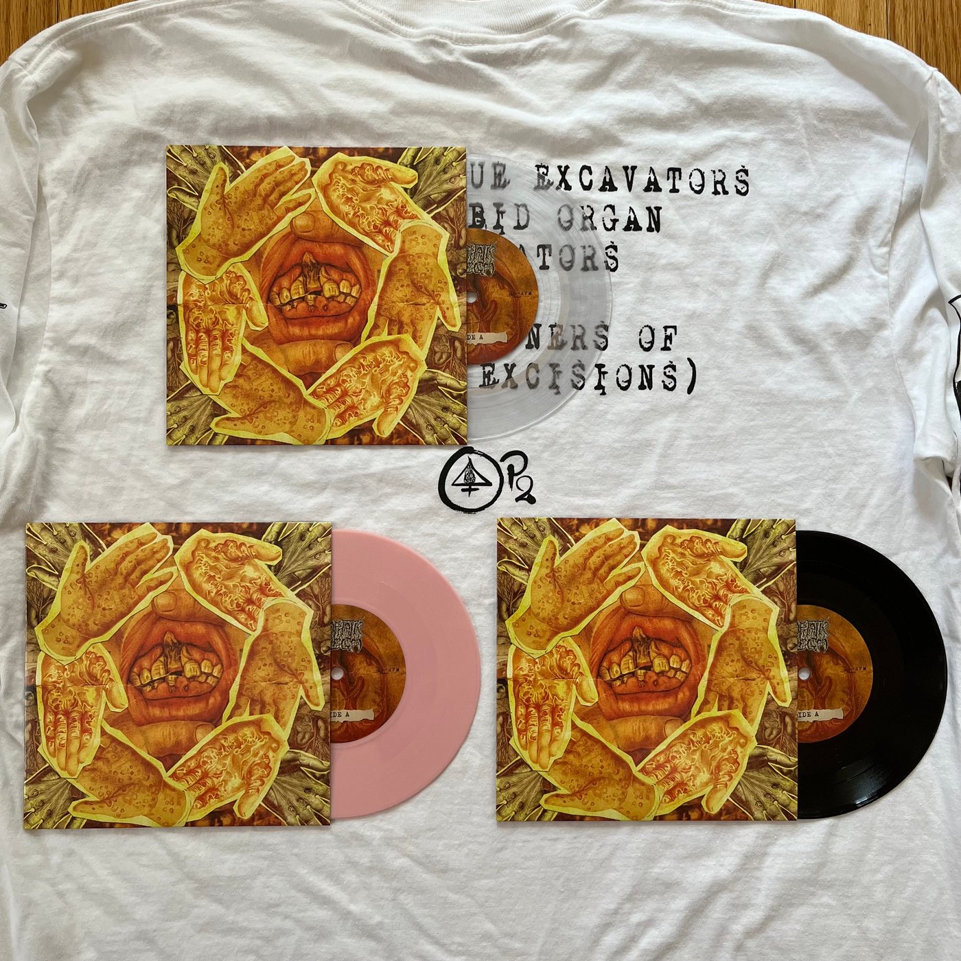 Lymphatic Phlegm – Vulgar Tissue Excavators and Morbid Organ Plastinators (Practitioners of Purulent Excisions) 7&quot;