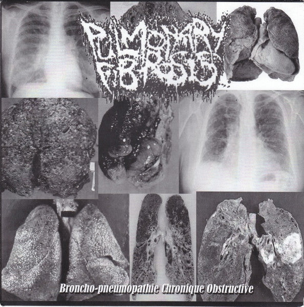 Pulmonary Fibrosis / Agathocles – Broncho-pneumopathie Chronique Obstructive / Suppository Of Speed 7&quot; vinyl (Rare / Used, VG+)