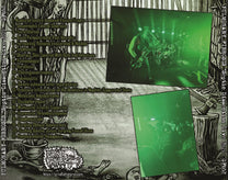 Pulmonary Fibrosis – Septic Dissection Live 2025 CD