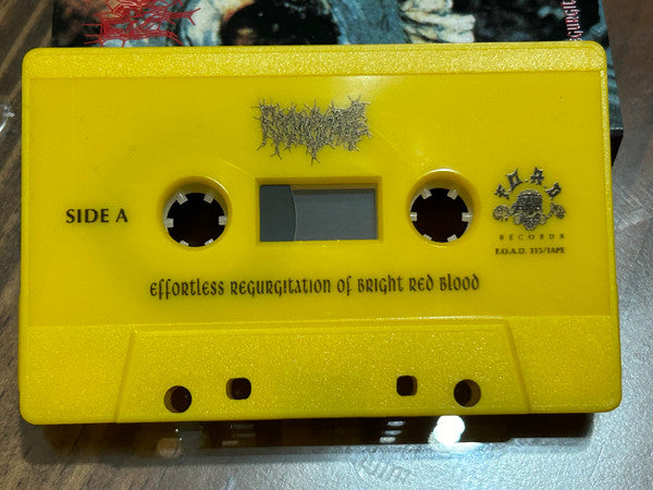 Regurgitate – Effortless Regurgitation Of Bright Red Blood MC