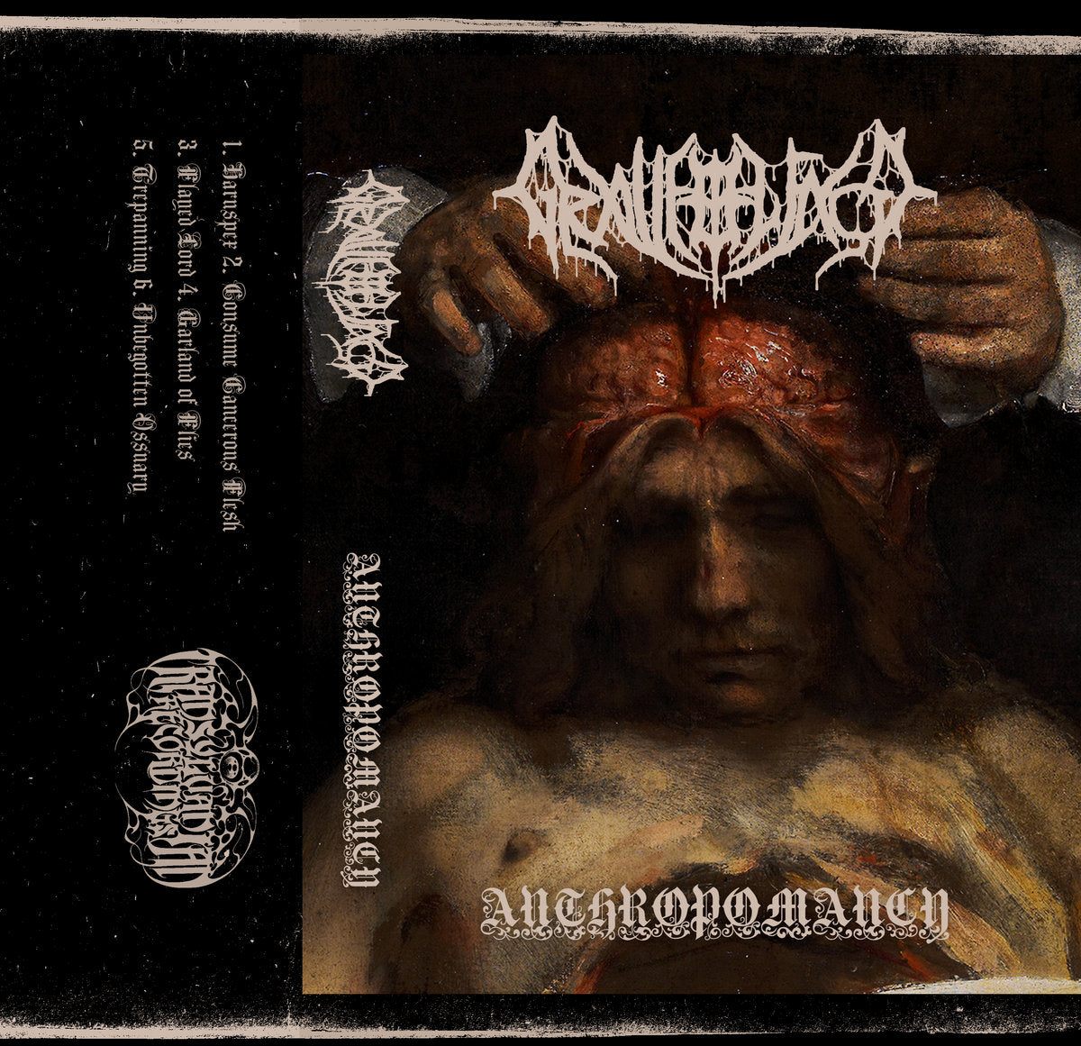 Graveolence – Anthropomancy MC
