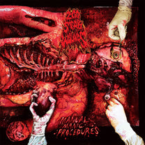 200 Stab Wounds – Manual Manic Procedures LP