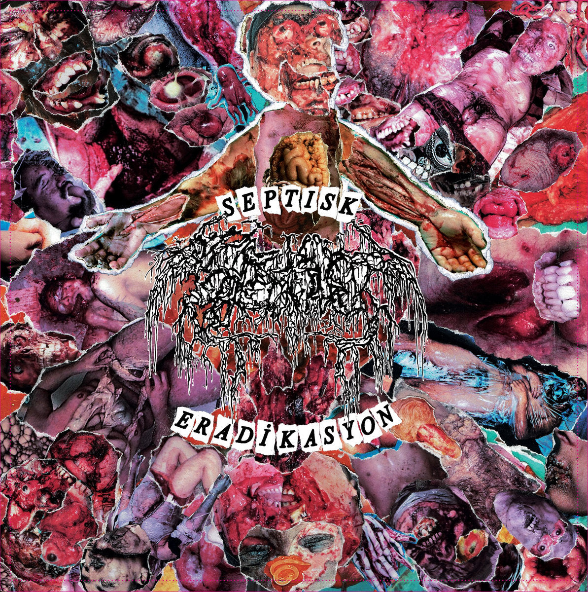 Septage – Septisk Eradikasyon CD