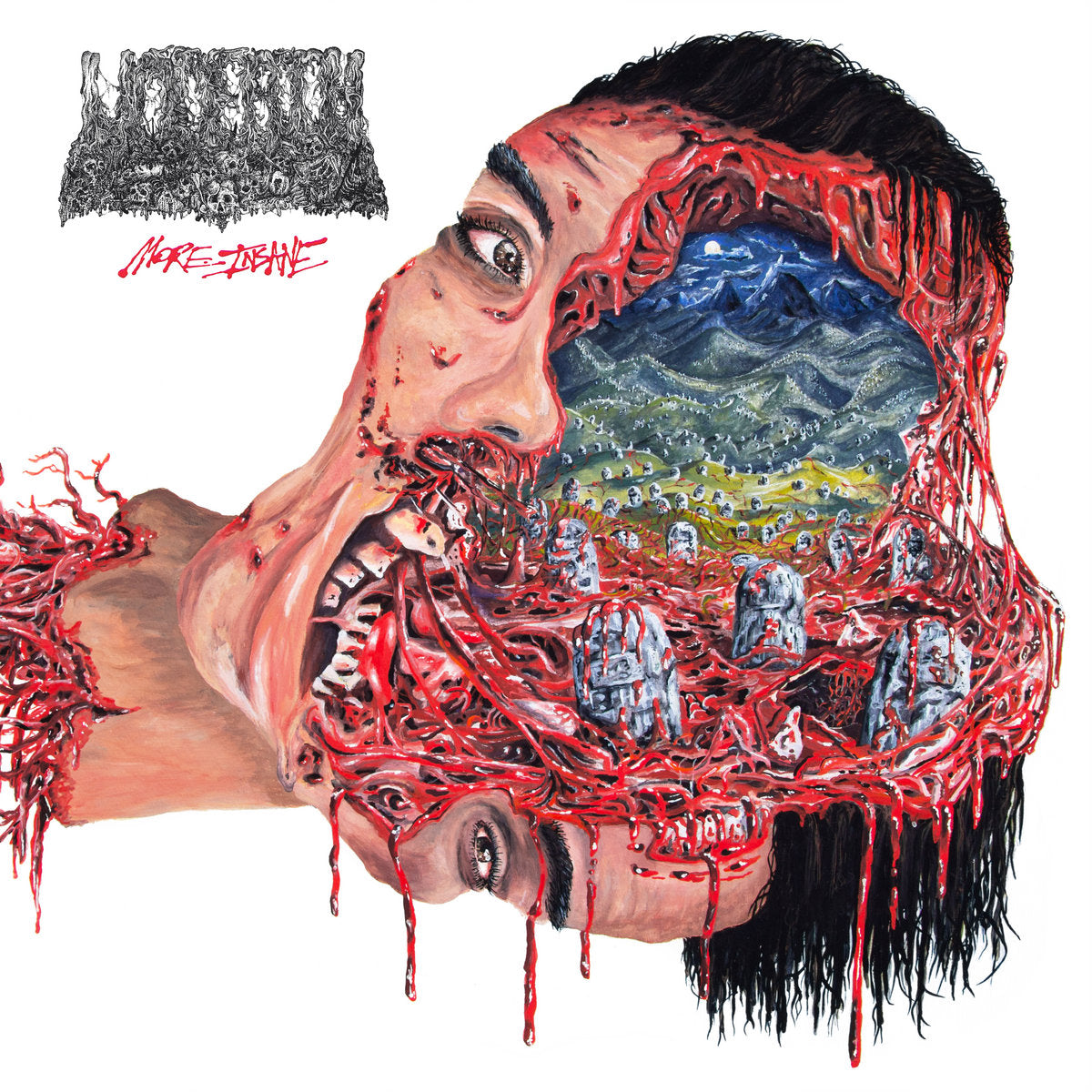 Undeath – More Insane LP