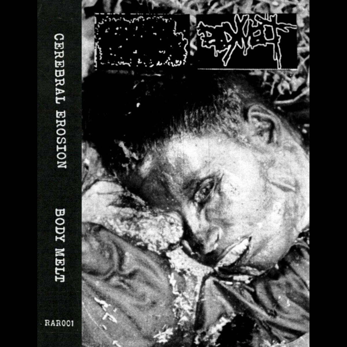 Cerebral Erosion / Body Melt – S/T Split MC