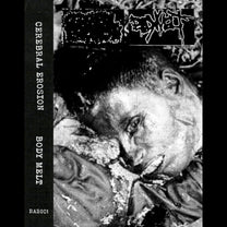 Cerebral Erosion / Body Melt – S/T Split MC