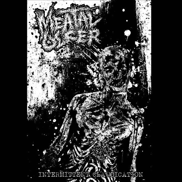 Meatal Ulcer – Intermittent Claudication 7&quot;